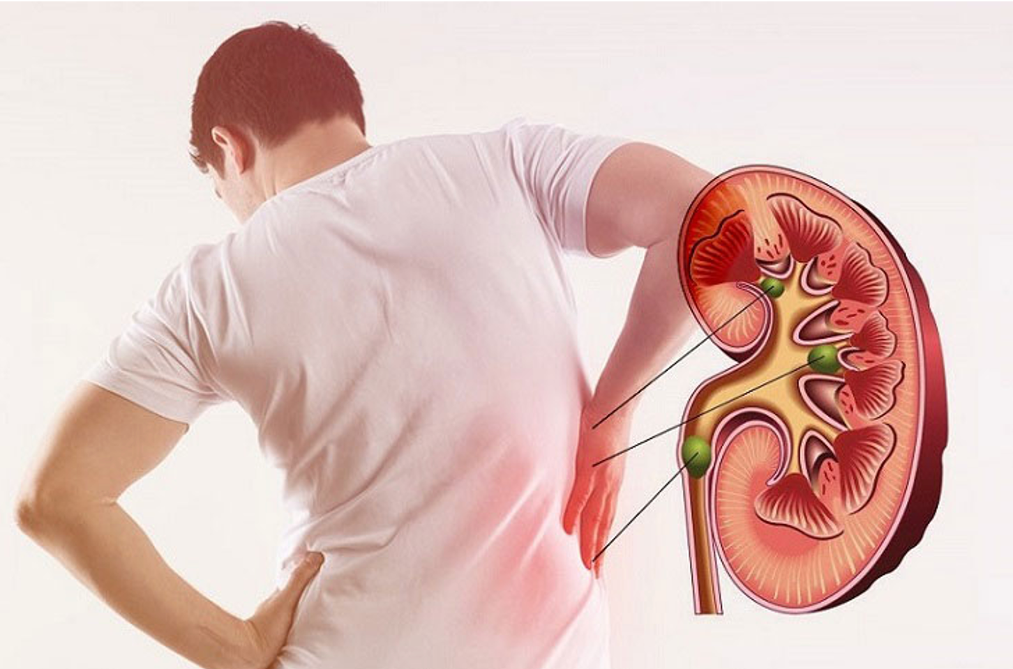 Dấu hiệu của bệnh suy thận