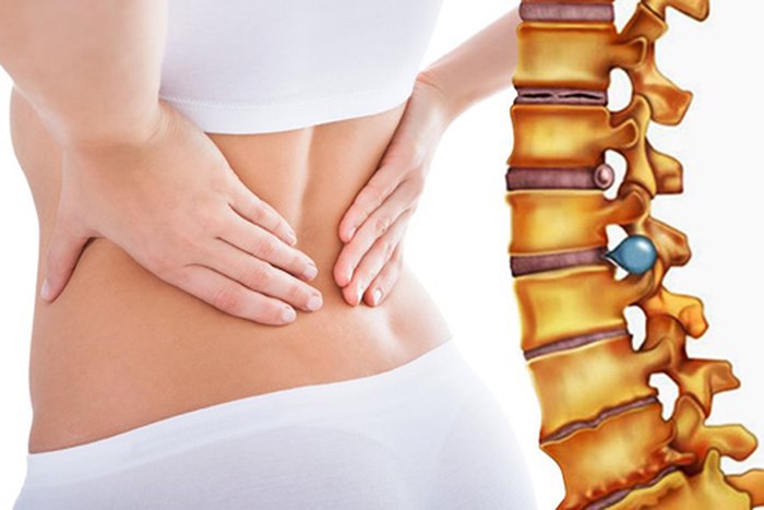 Người bị thoát vị đĩa đệm thường mắc phải 5 thói quen xấu này, cần bỏ ngay