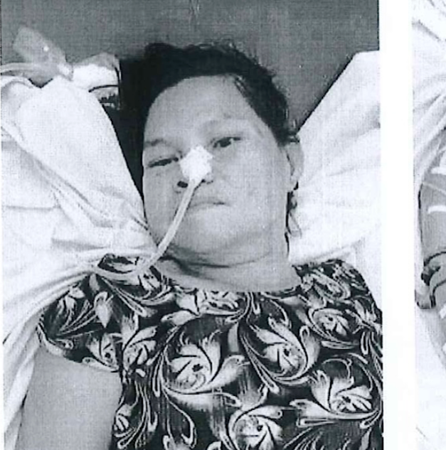 Bệnh nhân bị b: ỏ r: ơi ở bệnh viện đã tuvong, chưa ai đến nhận