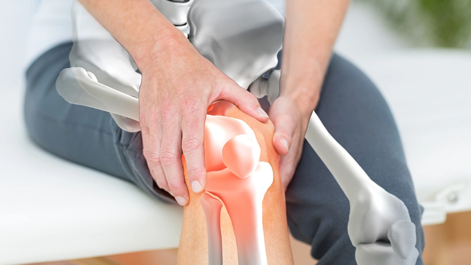 Người bệnh xương khớp dễ tái phát trong ngày mưa bão: 4 cách giảm đau nhức nhanh chóng nhất